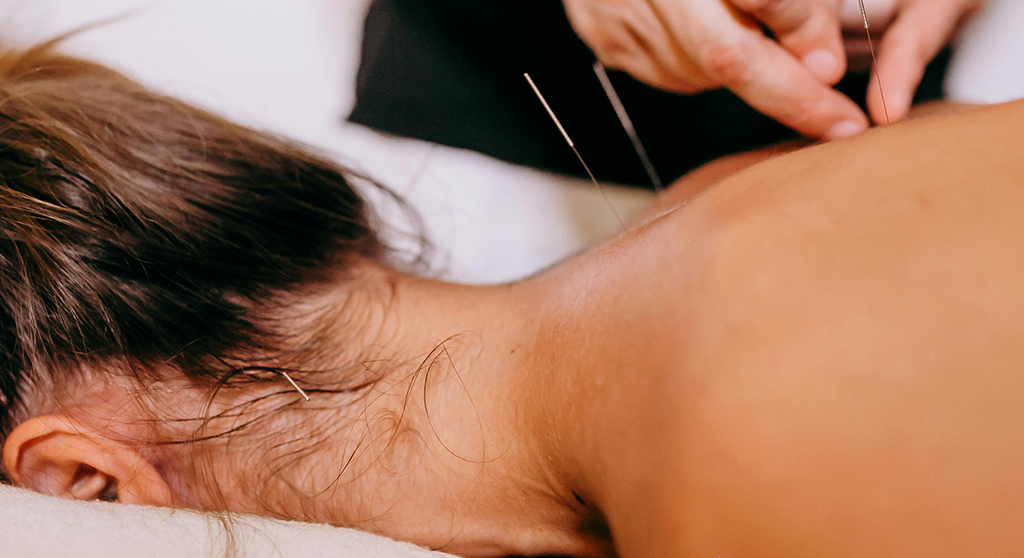 Is Acupuncture an Effective Pinched Nerve Treatment?